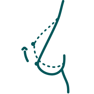 Breast Surgery