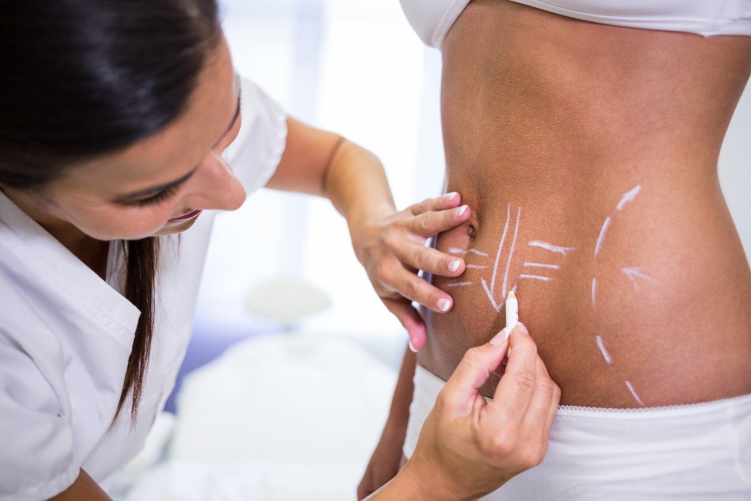 Best Tummy Tuck in Goa
